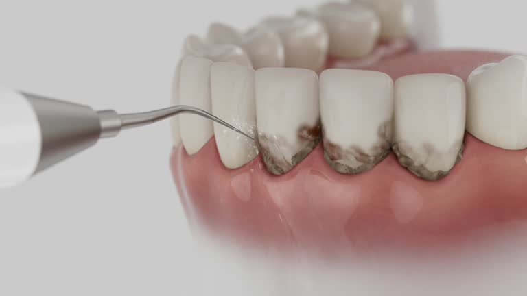 Trusted Dental Implants service in Churubusco, IN - Dentist Open Now